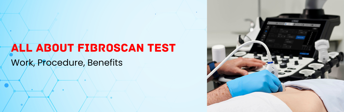 All About FibroScan Test